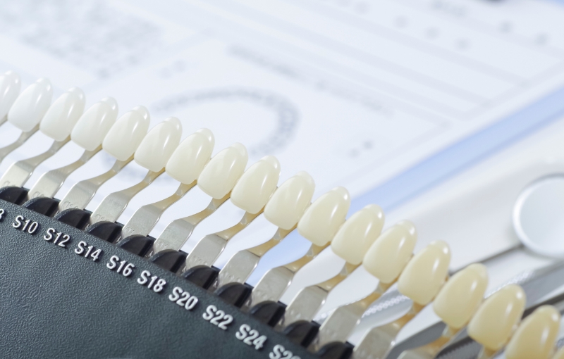 ホワイトニング