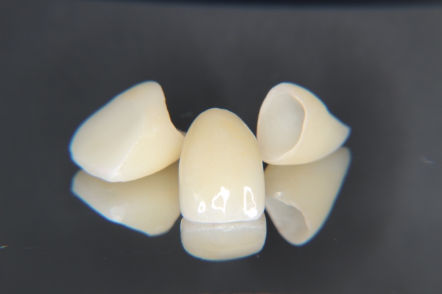 美しい見た目を再現できる