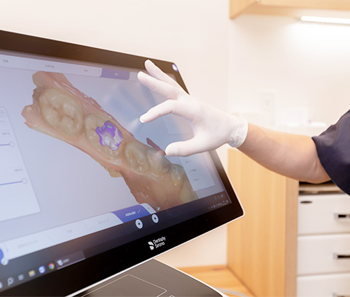 仮歯のチェックも丁寧で、何度も調整されるのですよね